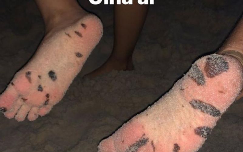 Whindersson Nunes publica foto de pés com manchas de óleo após visita a Alagoas
