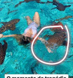 Influencer Ana Bruna Avila é mordida por tubarão nas Bahamas: 'Arrancou um pedaço do meu braço'