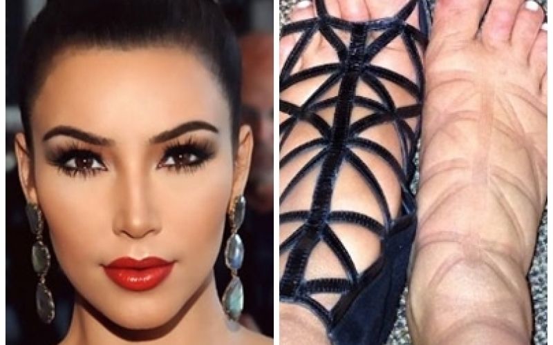 Grávida de sete meses, Kim Kardashian erra na sandália e circula com pé inchado