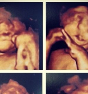 Jaque Khury mostra rosto do filho no ultrassom: “Não vejo a hora de ele nascer”